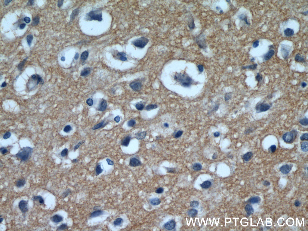 EAAT3 Polyclonal antibody