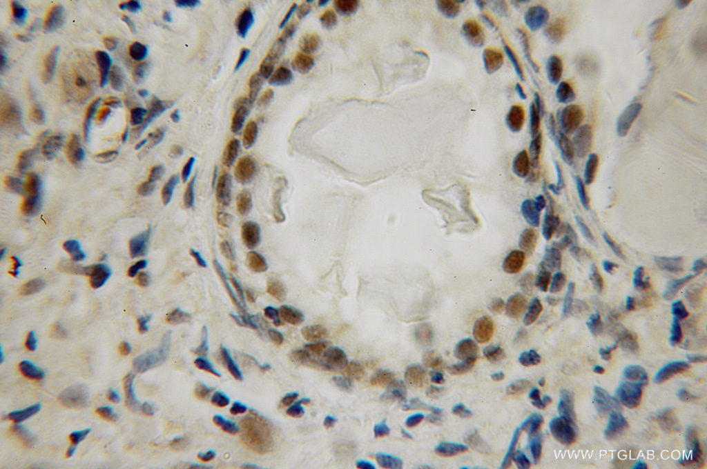 LIG4 Polyclonal antibody