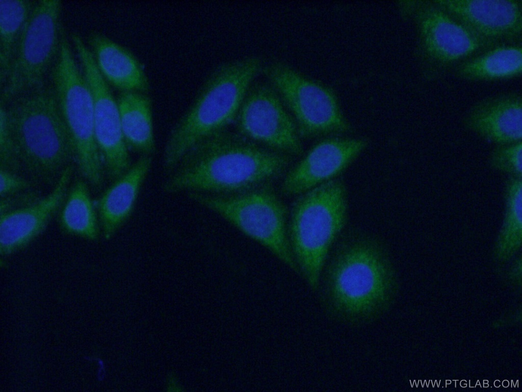 KIFAP3 Polyclonal antibody
