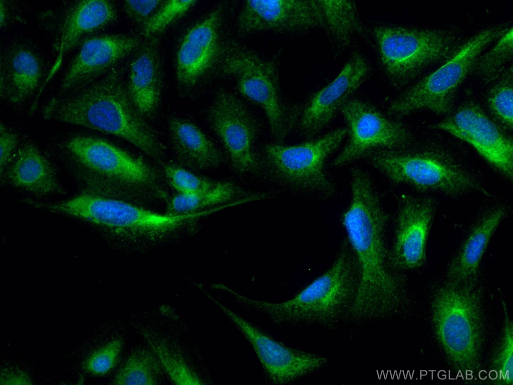 BMPR1A Polyclonal antibody