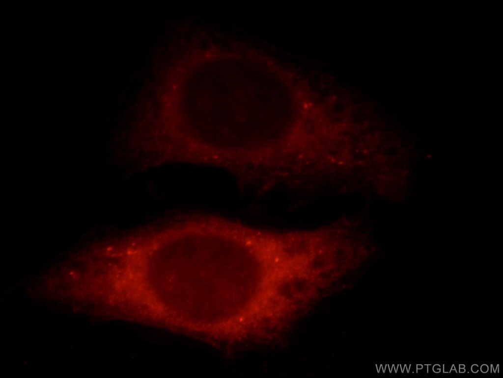 SHKBP1 Polyclonal antibody