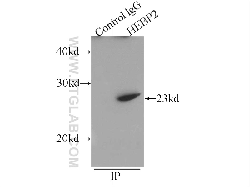 HEBP2 Polyclonal antibody