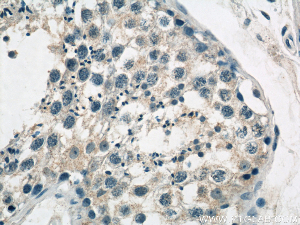 GCNF Polyclonal antibody
