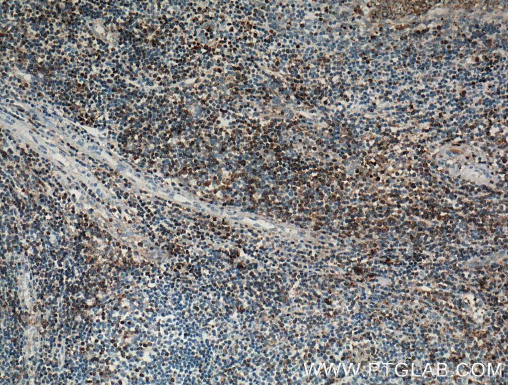 SLP76 Polyclonal antibody