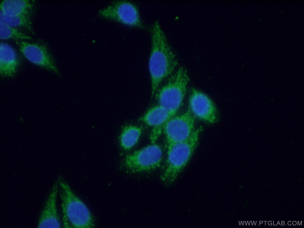 SEC5/EXOC2 Polyclonal antibody