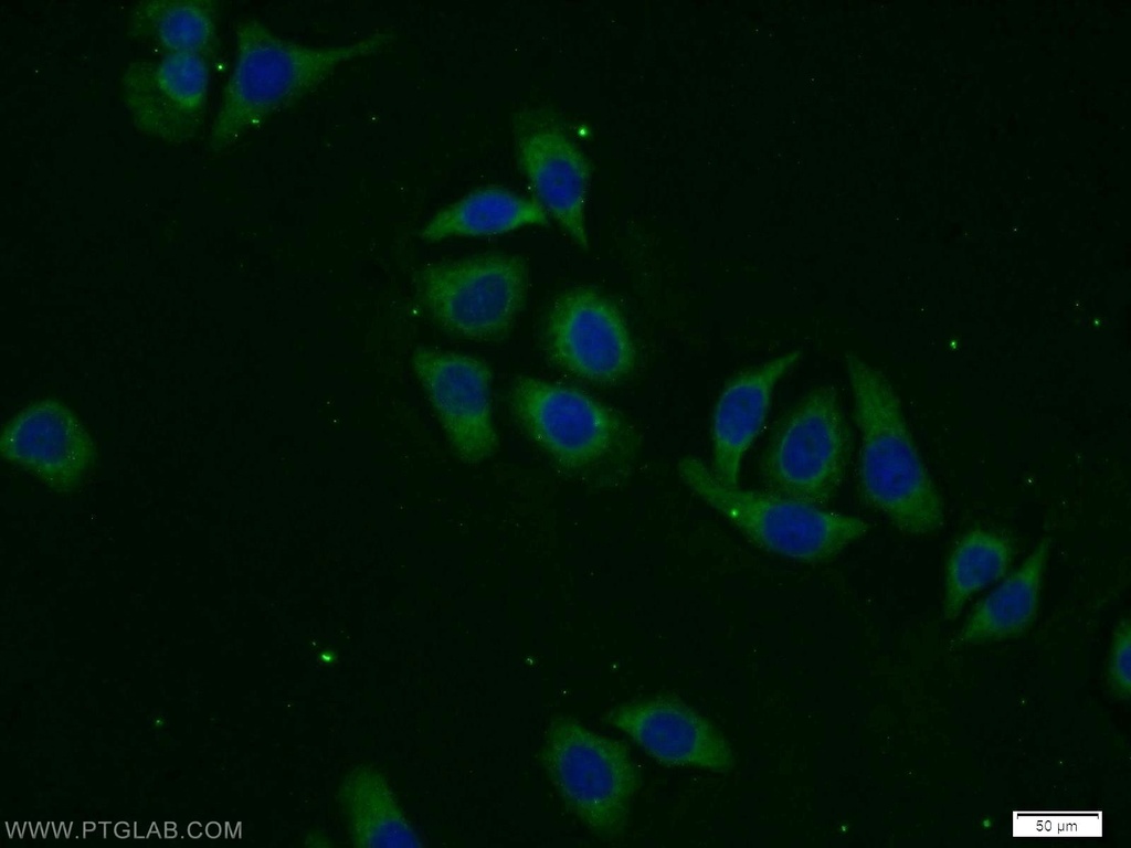 DPP8 Polyclonal antibody