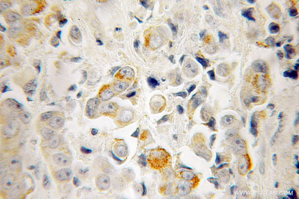 RTKN Polyclonal antibody
