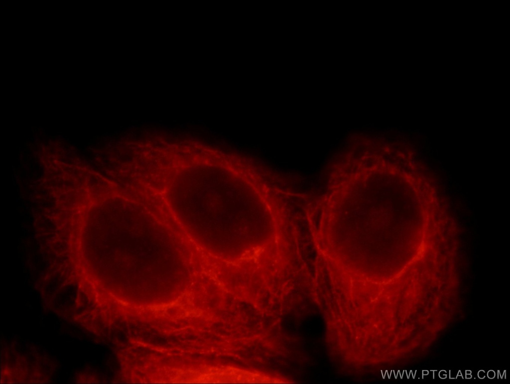 MYCBPAP Polyclonal antibody