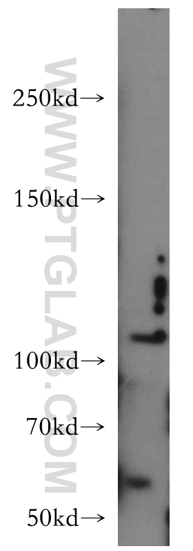 CNTN4 Polyclonal antibody