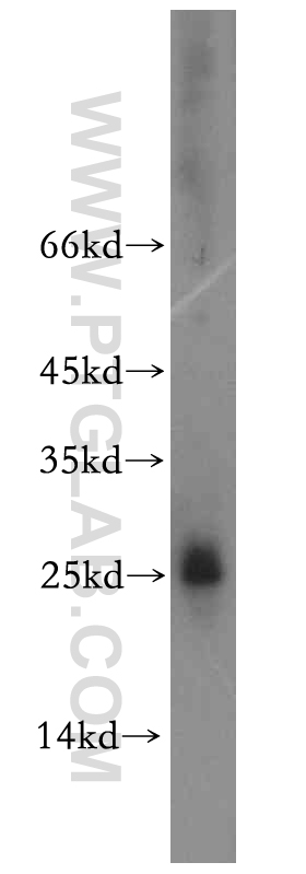 HMGB4 Polyclonal antibody