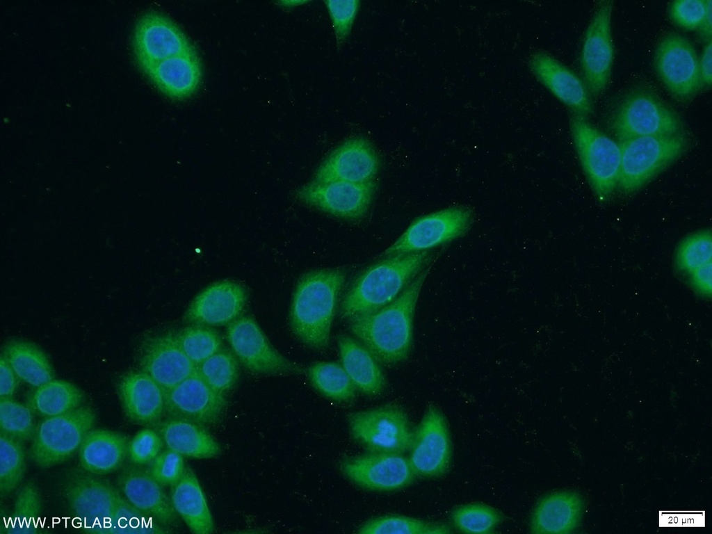 SECISBP2 Polyclonal antibody