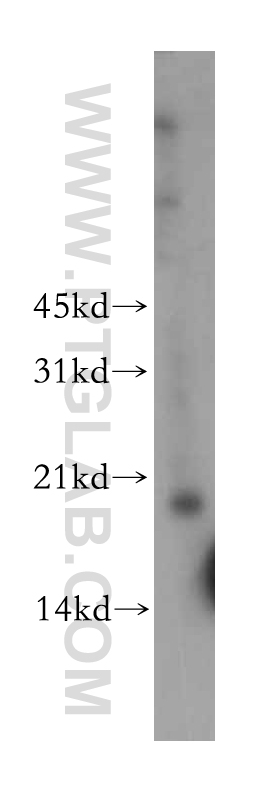 TPRKB Polyclonal antibody