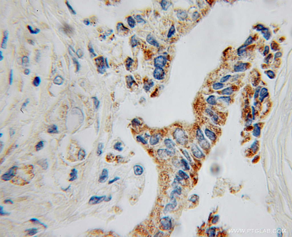 GATM Polyclonal antibody