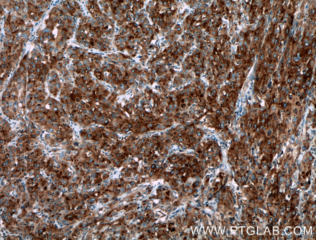 SEPT6 Polyclonal antibody