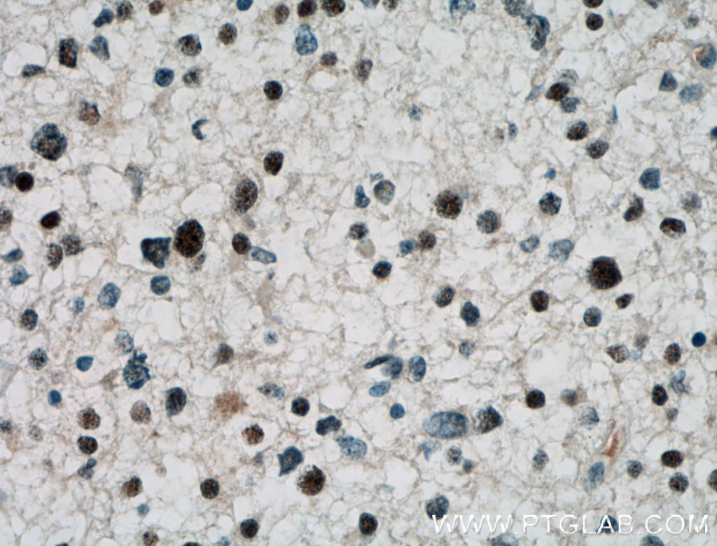 ARNT2 Polyclonal antibody