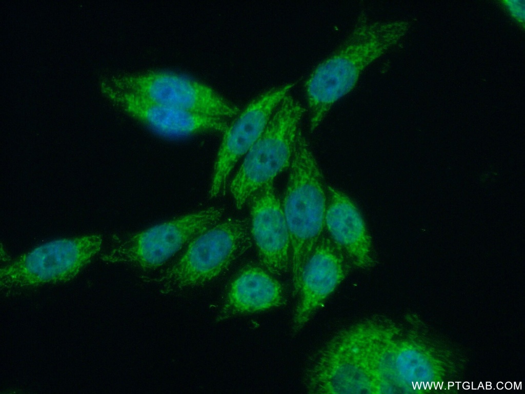 SUPV3L1 Polyclonal antibody