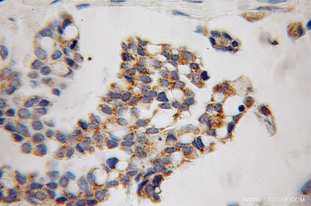 MAP4K5 Polyclonal antibody