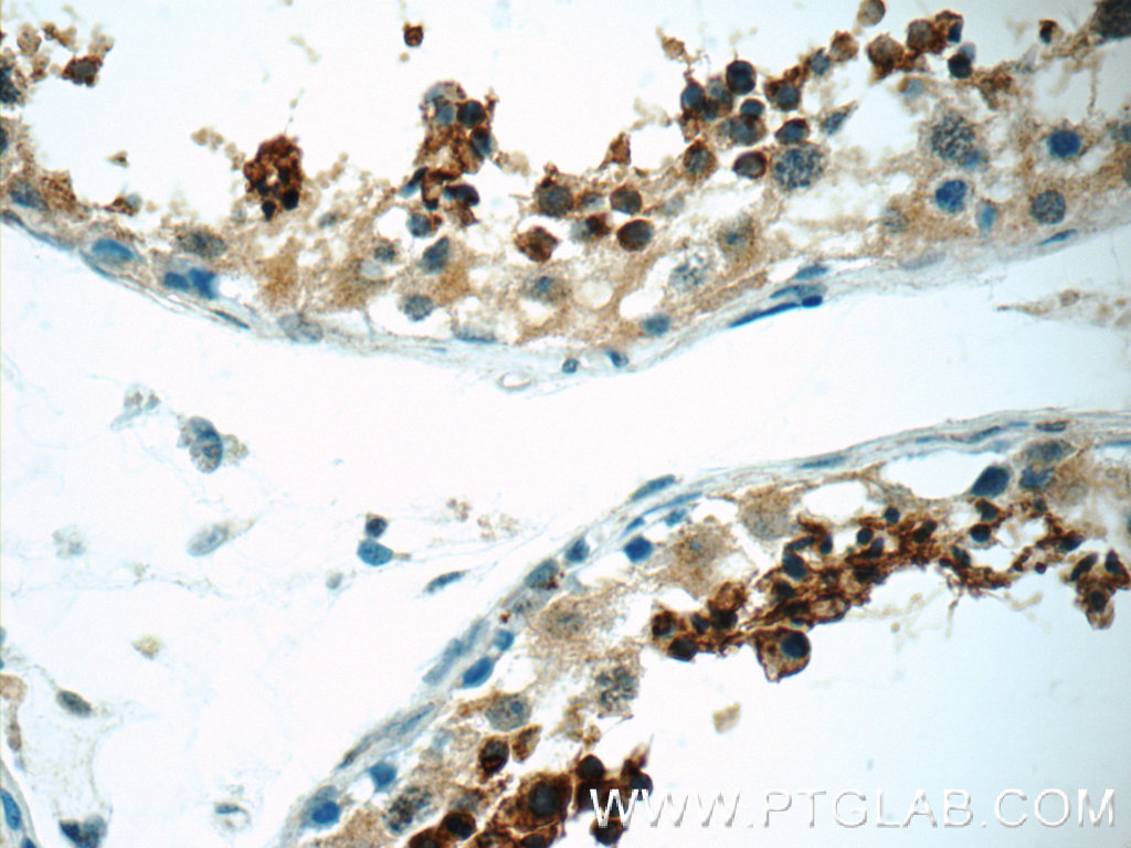 SPACA1 Polyclonal antibody