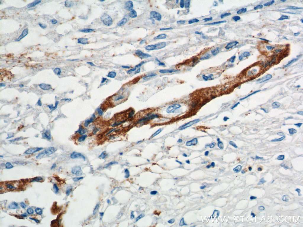XK Polyclonal antibody