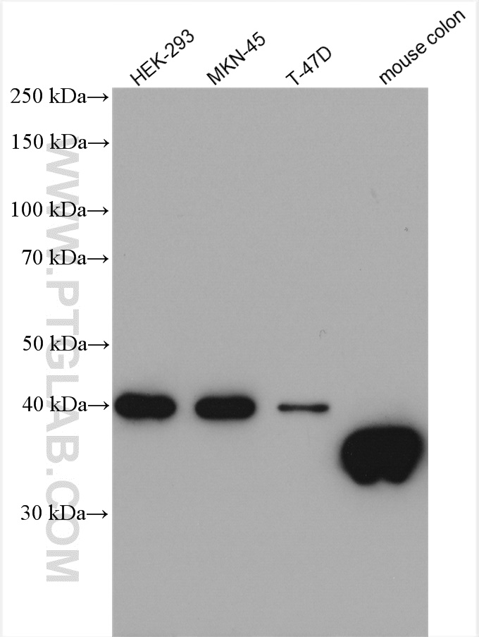 GIPC2 Polyclonal antibody