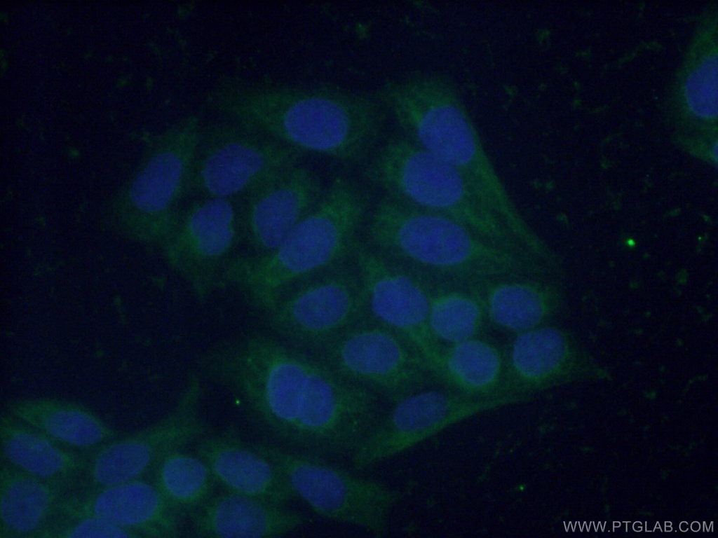 FBP1 Polyclonal antibody