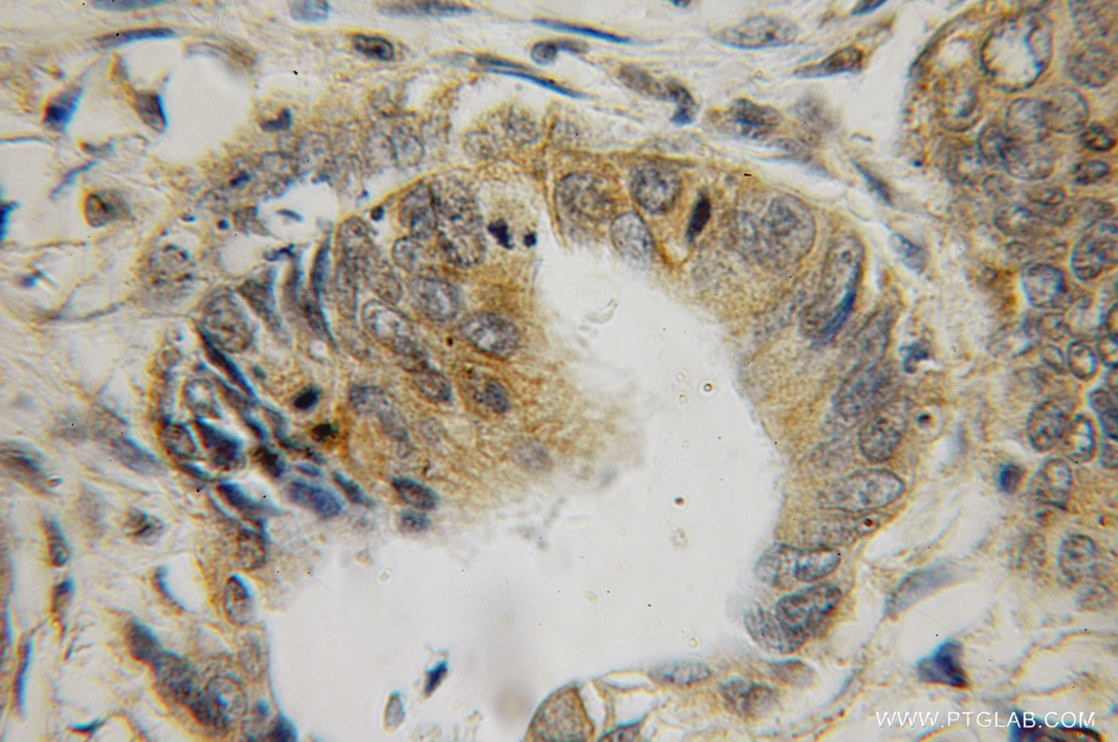 Galectin 2 Polyclonal antibody