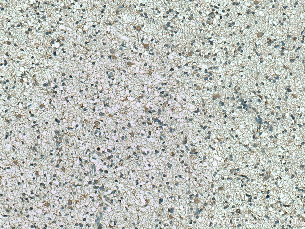CMIP Polyclonal antibody
