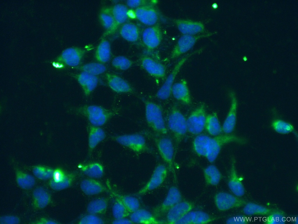 KGA/GAC Polyclonal antibody