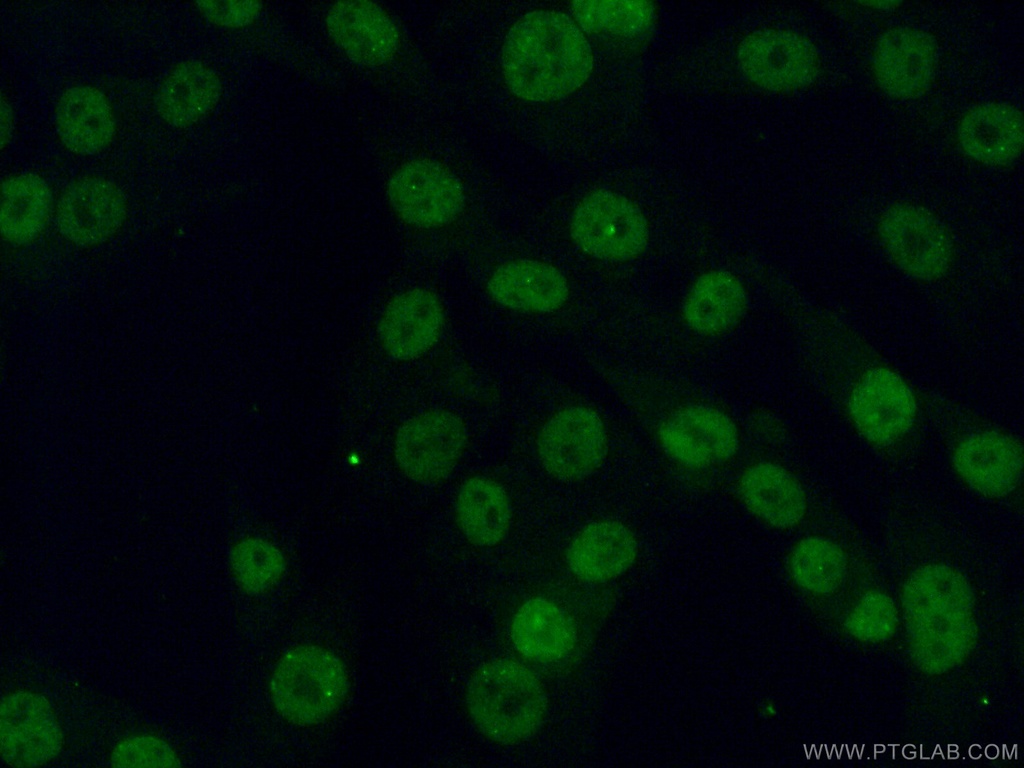 PHC2 Polyclonal antibody