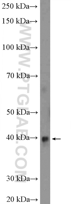 RPP38 Polyclonal antibody