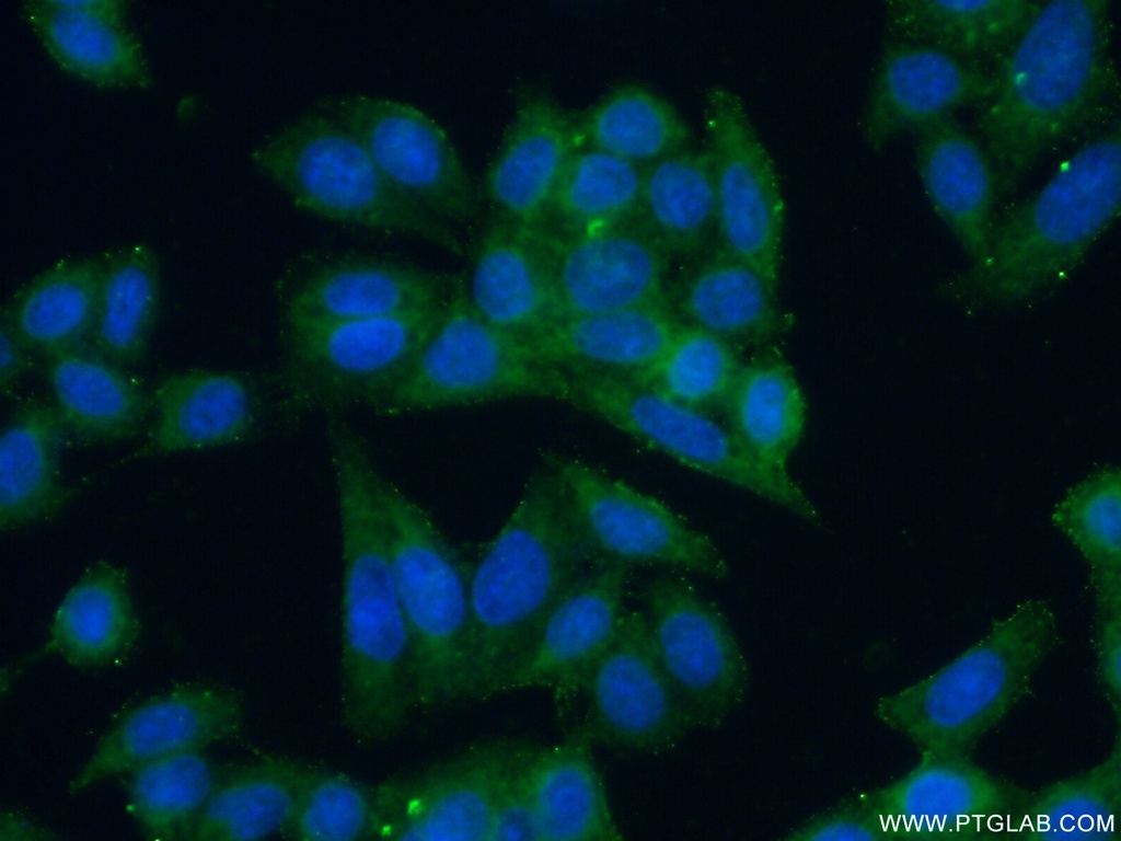 GJB3 Polyclonal antibody