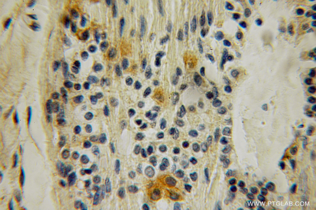 SH2D3C Polyclonal antibody