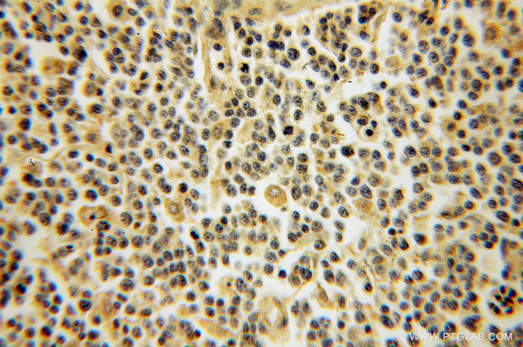 DYRK4 Polyclonal antibody