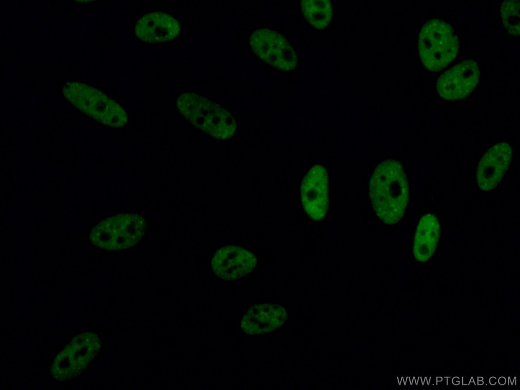 TDP-43 (C-terminal) Polyclonal antibody
