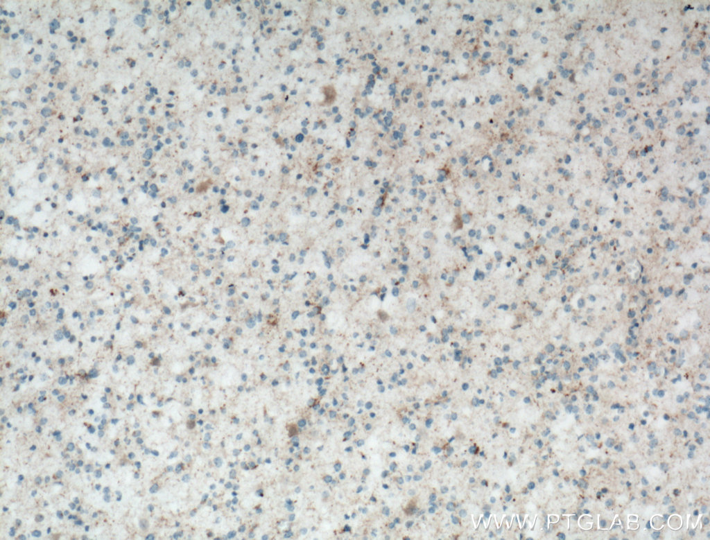 RCAN2 Polyclonal antibody