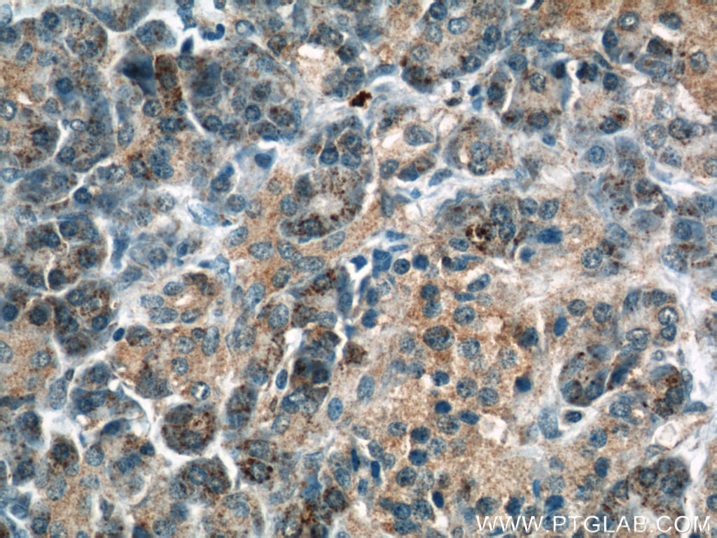 THADA Polyclonal antibody