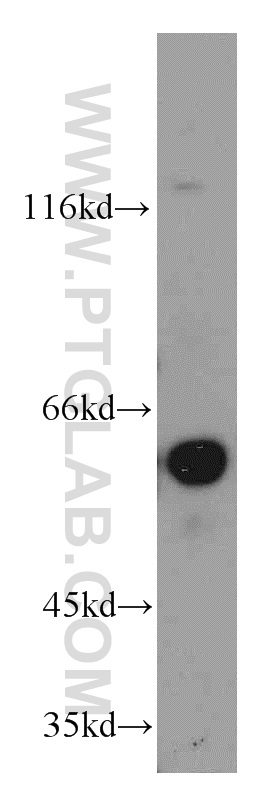 Netrin G1 Polyclonal antibody