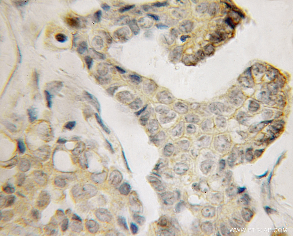 BVES Polyclonal antibody
