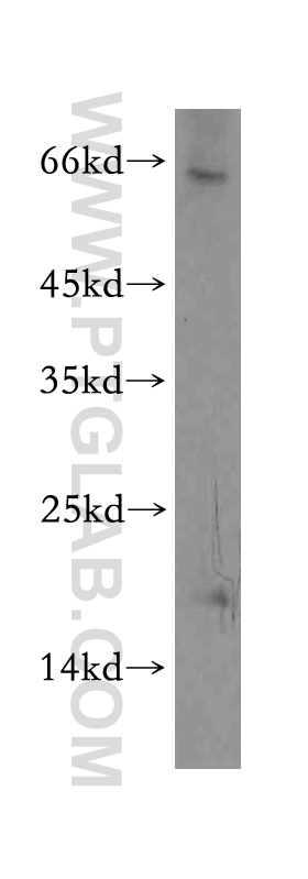 TXNL4B Polyclonal antibody