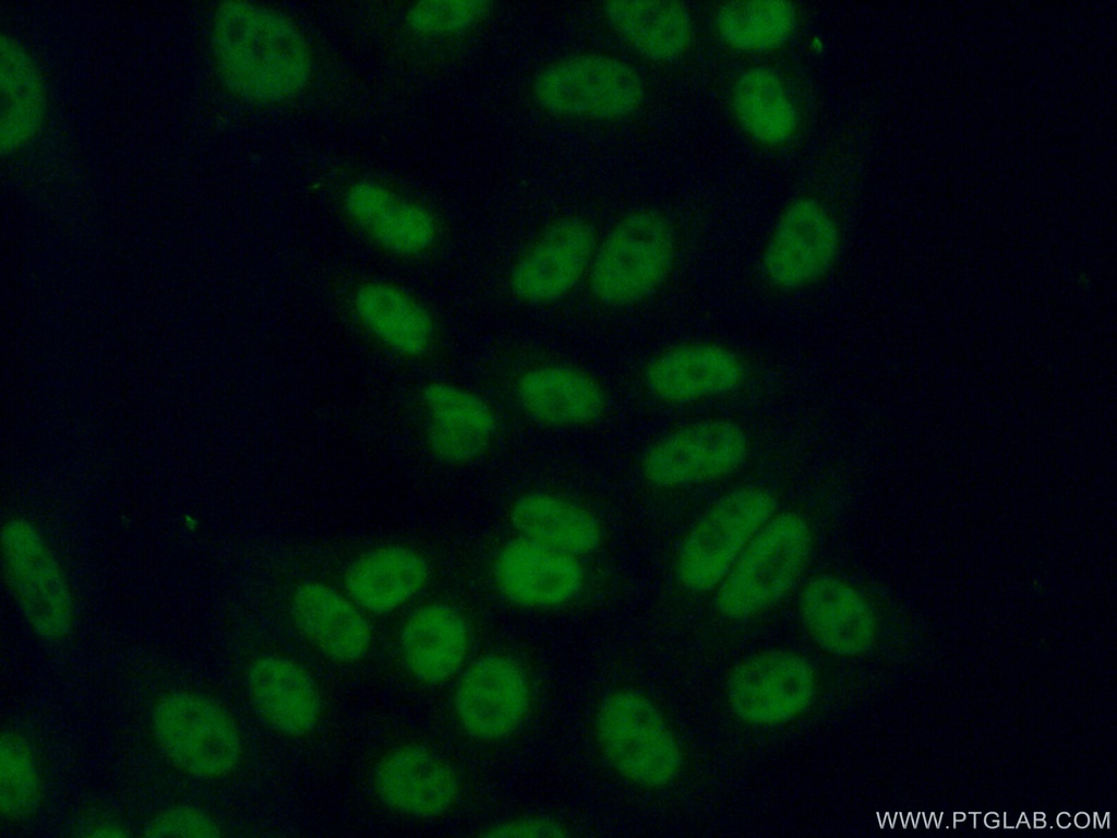 ASF/SF2 Polyclonal antibody