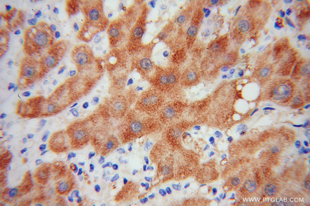 HRSP12 Polyclonal antibody