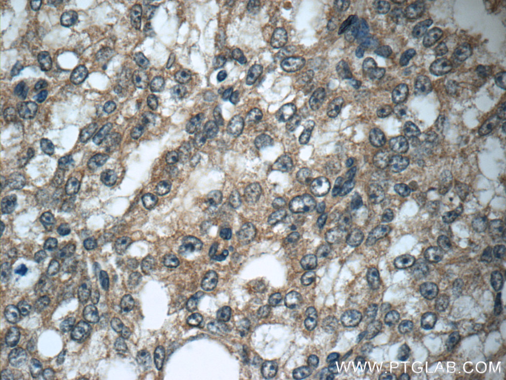 GAGE7 Polyclonal antibody