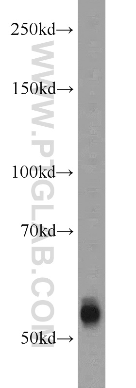 TMPRSS6 Polyclonal antibody
