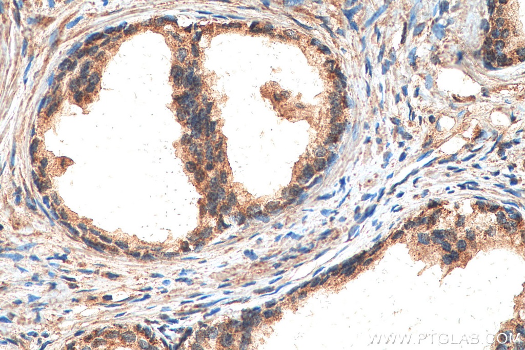 ILK Polyclonal antibody