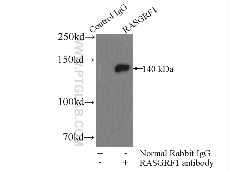RASGRF1 Polyclonal antibody