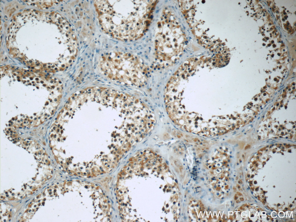 TEKT3 Polyclonal antibody