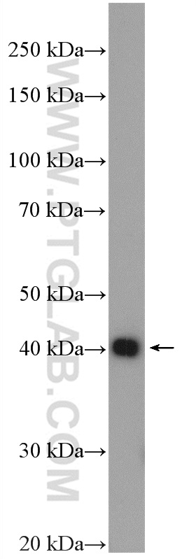 CHAD Polyclonal antibody