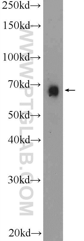 BNIP3L Polyclonal antibody