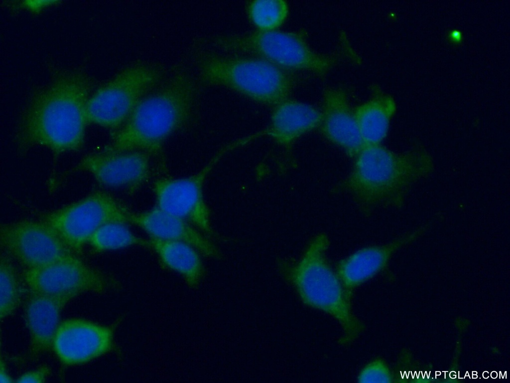 GSPT2 Polyclonal antibody