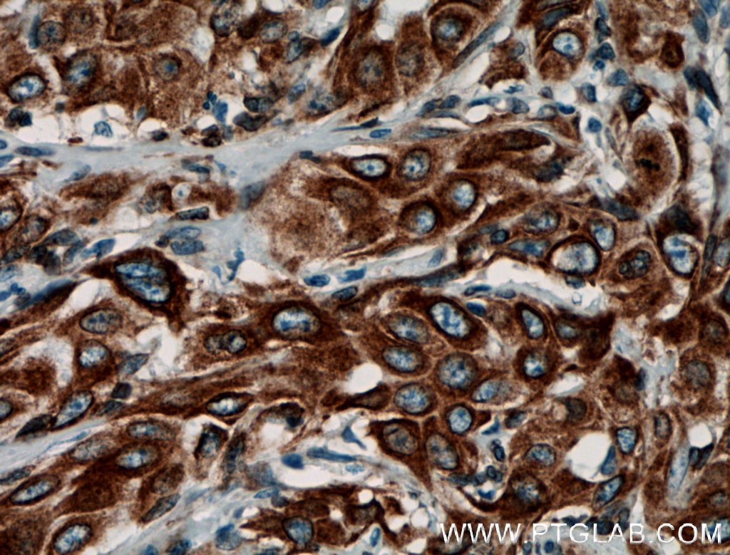 PGRMC1 Polyclonal antibody